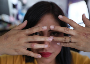 “Vivir sin miedo”, el reto de una víctima de intento de feminicidio en México