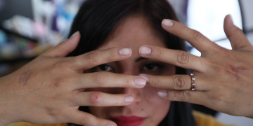 “Vivir sin miedo”, el reto de una víctima de intento de feminicidio en México